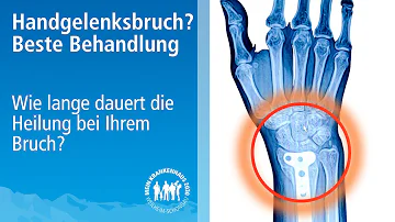 Wie lange hat man Schmerzen nach handgelenksbruch?