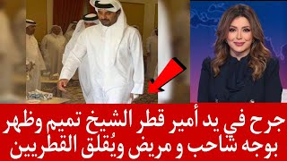 جرح في يد أمير قطر الشيخ تميم وظهر بوجه شاحب و مريض ويُقلق القطريين و العرب