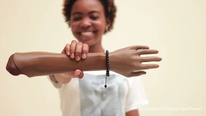 Victoria Hand Project extends its reach