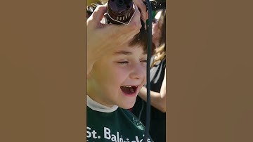 5 Reasons to Go Bald