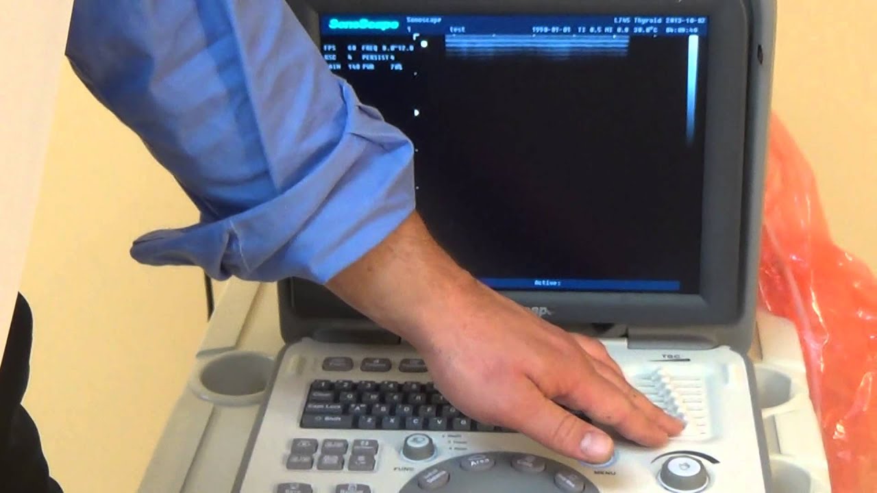 SonoScape A6 Ultrasound | Basic Functions