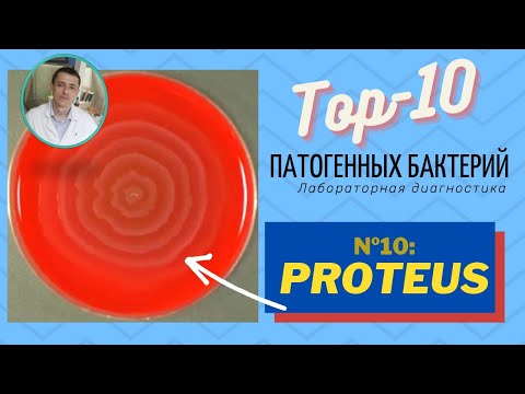 Видео: Proteus mirabilis байсан уу?