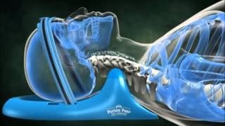 Why We Need Posture Pump for Neck Pain Model 1100S
