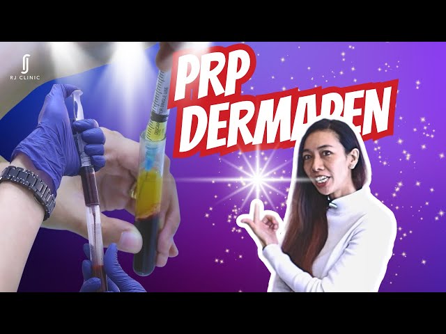 Glowing Skin Unveiled: RJ Clinic's PRP Dermapen Treatment class=