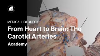 From Heart to Brain: The Carotid Arteries screenshot 3