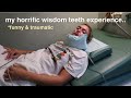 I got my wisdom teeth out and it went horribly wrong.....