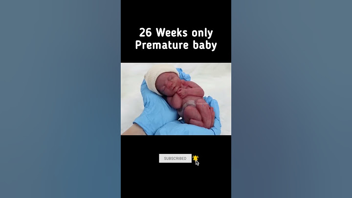 26 Weeks Premature Baby👶👶 #pregnancy #premature #newbornbaby #baby