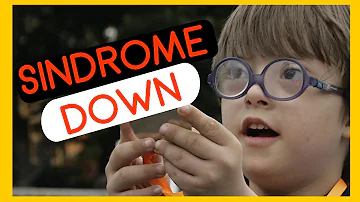 ¿Qué era antes el síndrome de Down?