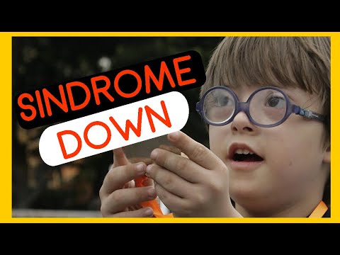 Vídeo: La síndrome de Down és causada per un canvi en l'ADN?