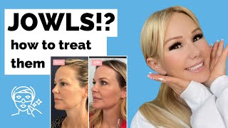 JOWLS!? How to treat them without surgery! Thermafrax, thread lifts, fillers, botox, more