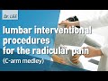 The technique of lumbar transforaminal injection for radicular pain  c arm medley series 1