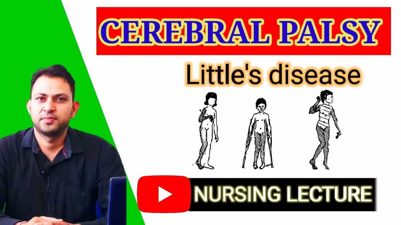 cerebral palsy | torch test | types of cerebral palsy | Nurses Tech Online #NursingClasses