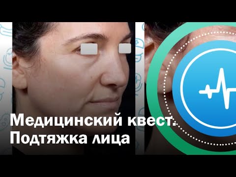 Медицинский квест. Подтяжка лица