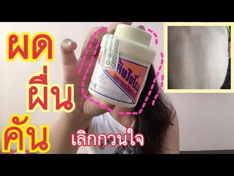 ผด ผื่น คัน เลิกกวนใจ ด้วยแป้งเย็นสูตรโบราณสูตรนี้เลย|ครูแอ๋วMashare