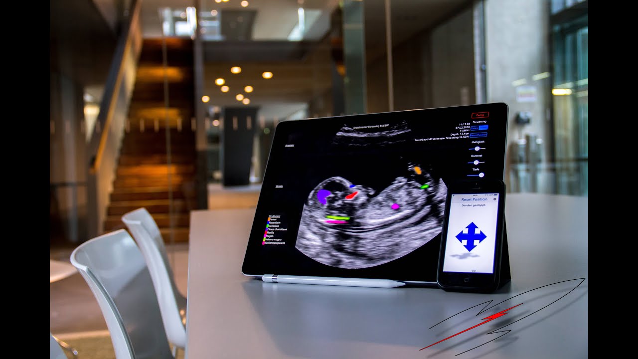 Introducing Scanbooster Ultrasound Simulator