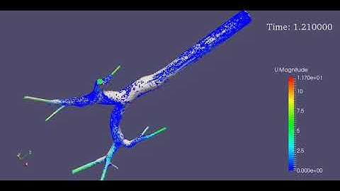 CFD of magnetic nano drug targeting in lower respiratory tract
