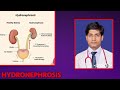 Short on hydronephrosis  hydronephrosis   dr brahmanand lal    part 2 