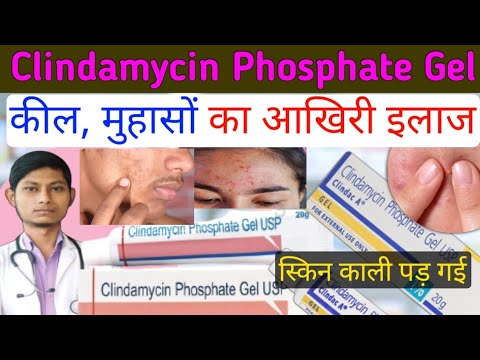 Clindamycin phosphate gel usp - कील मुहासों का आखिरी इलाज