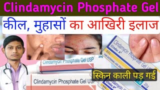 Clindamycin Phosphate Gel Usp - कल महस क आखर इलज Clindac A Gel Clear Gel Cream