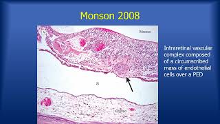 2024 RIMR Tutorial - Richard Spaide, MD - OCT Angiography