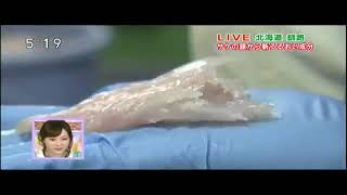 NHK特集（プロテオグリカン）