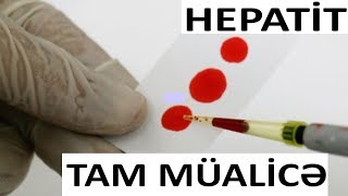 Hepatit xəstəliklərinin TAM müalicəsi - Həkim məsləhəti