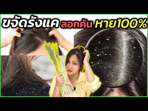 รังแคเต็มหัว เชื้อรา คันหนังศีรษะ!! รีบใช้สูตรนี้ ไร้สารเคมีด้วยสมุนไพรไทย หายจริง100% l สรรหามาทำ