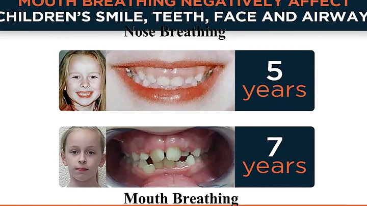 Why you should always breathe through your nose - The Nitric Oxide Miracle - Humming