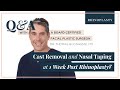 Cast Removal Aftercare and Nasal Taping Discussion with Ashley - RHINOPLASTY Q&A WITH DR. BUONASSISI