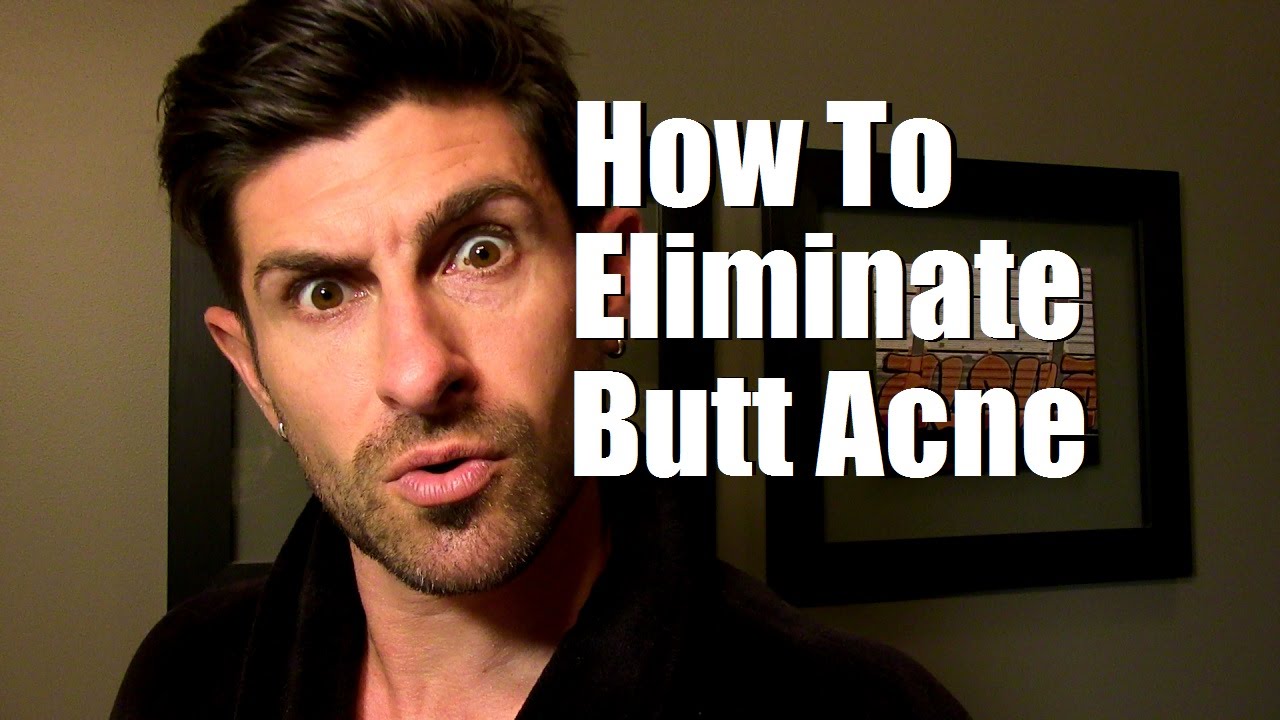 How To Eliminate Butt Acne Buttne Stop Butt Breakouts