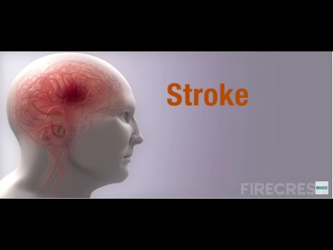 FIRECREST Medical Animations: Stroke