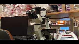 New study suggests link between COVID-19 and diabetes