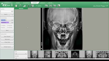 EZDent i, Chapter 03 00   Viewer Tab Layout FINAL