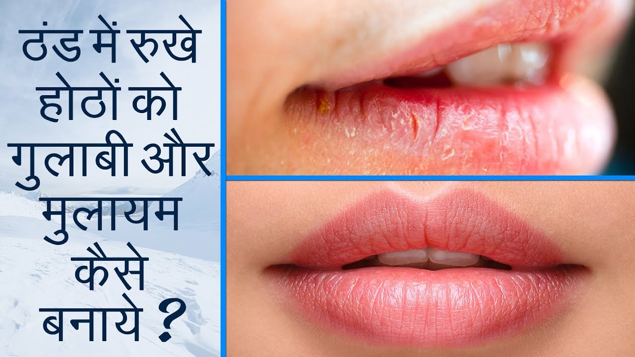 ठंड में रूखे होठों को गुलाबी और मुलायम कैसे बनाये Winter Lip Care