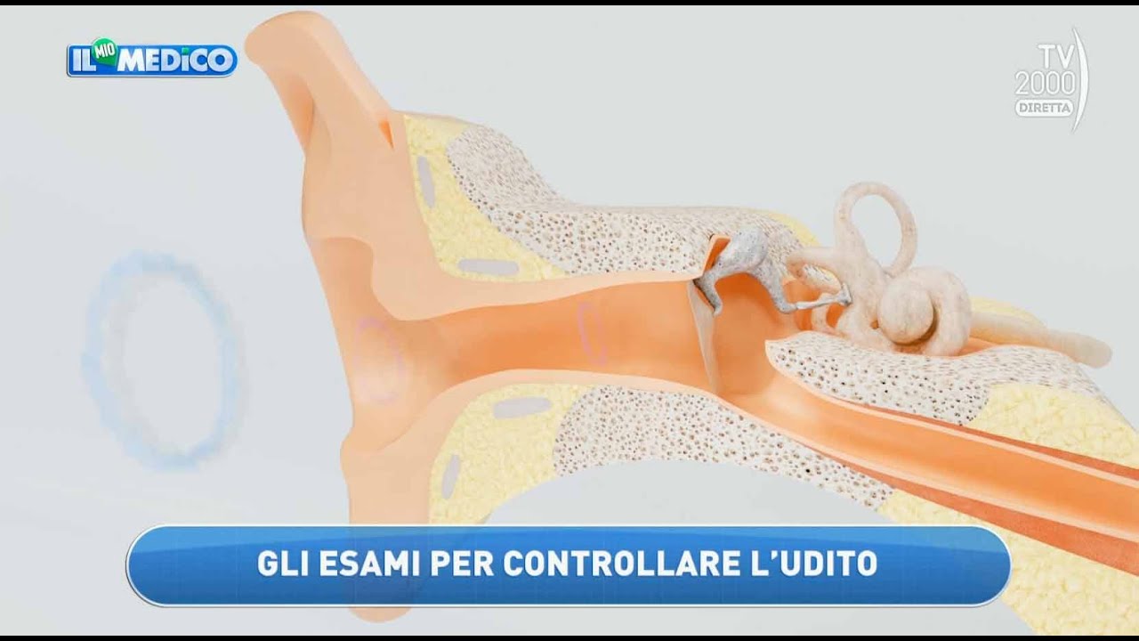 Il Mio Medico (Tv2000) - Gli esami per controllare la salute delle ...