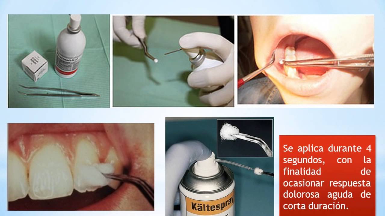 Diagnostico en Endodoncia YouTube