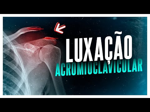 Vídeo: Como tratar uma luxação: 9 etapas (com fotos)