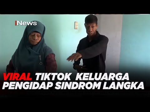 Video: Seorang Gadis Dengan Sindrom Langka Ingin Tumbuh Besar Secepat Mungkin - Pandangan Alternatif