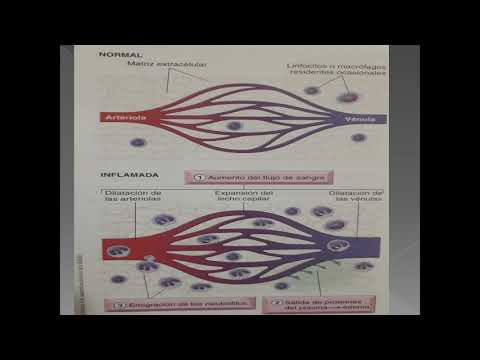 CLASE TEÓRICA 6 - INFLAMACIÓN Y REPARACIÓN TISULAR PARTE 1