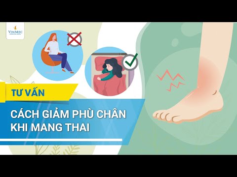 Video: Cách Xác định Sưng Khi Mang Thai