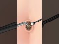 ASMR Navel Stone Belly Button Ring Remove Animation ASMR Navel Stone Belly Button Ring Remove Animation