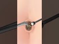 ASMR |  Navel Stone  Belly Button Ring Remove Animation