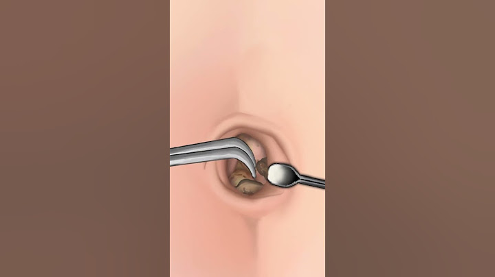 ASMR |  Navel Stone  Belly Button Ring Remove Animation