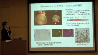 分子神経生物学:筑波大学大学院修士 医学系専攻 研究室紹介動画 分子神経生物学:筑波大学大学院修士 医学系専攻 研究室紹介動画