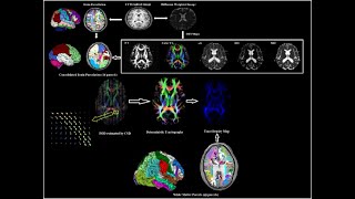 MRI Physics of Diffusion Tensor Imaging and Tractography Part 23