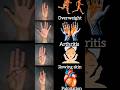 Daily Mudra #overweight​ #arthritis​ #glowing #skin #skincare #weightloss #arthritis #focus #pain