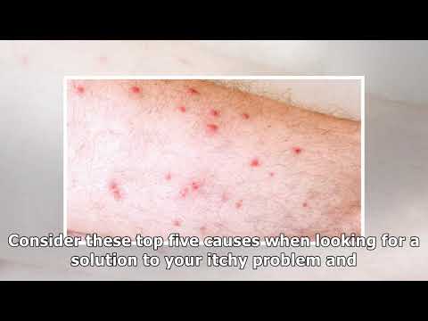 red-bumps-on-legs:-how-to-recognize-the-symptoms-and-learn-the-treatments