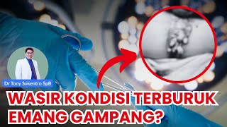 JADI DOKTER WASIR , CONDILOMA, FISURA, STRIKTUR AN*S EMANG GAMPANG ? #wasir #condiloma #fistula