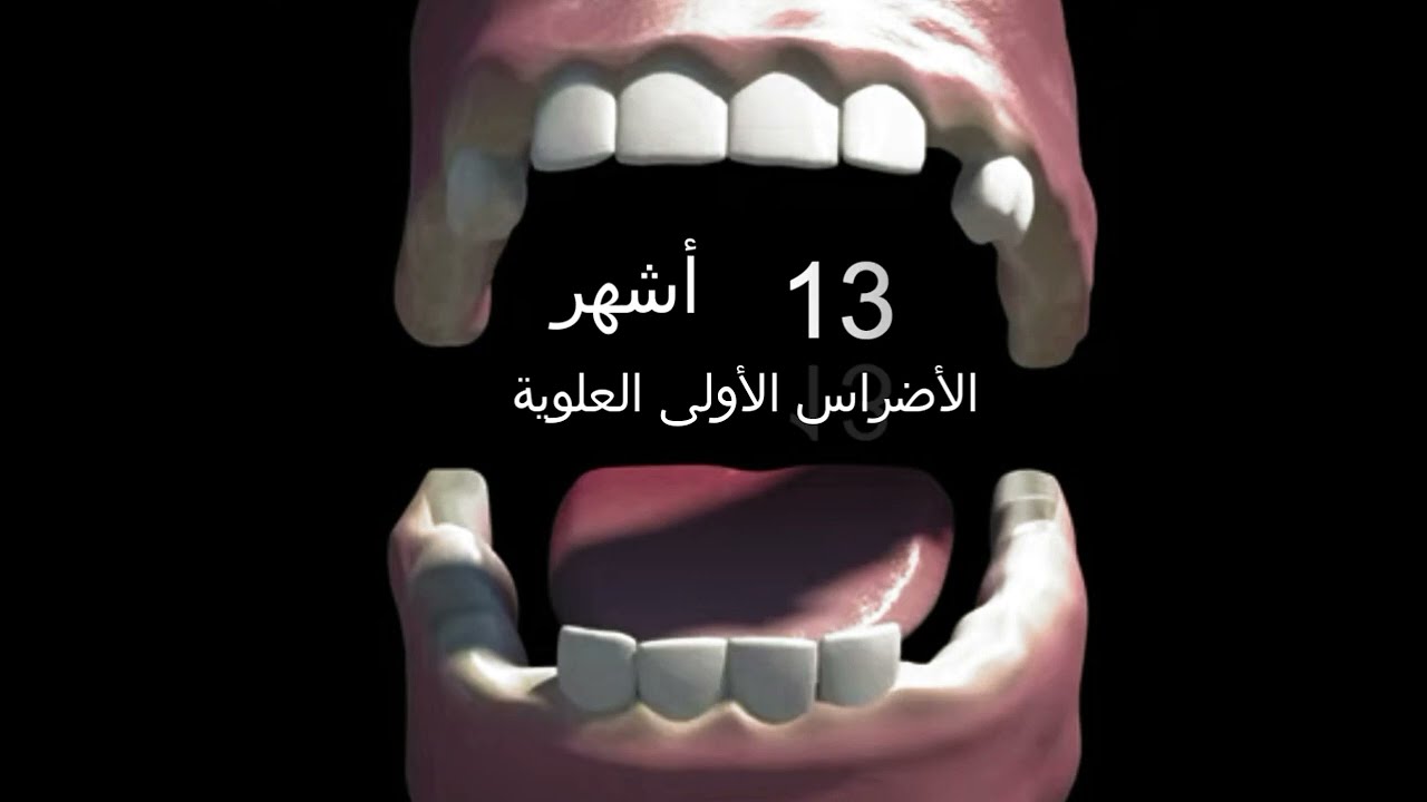 ترتيب ظهور الأسنان عند الرضع