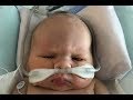 Baby opens eyes after esophagus surgery! | Meet the Millers